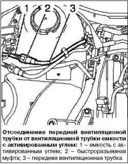 Замена передней вентиляционной трубки